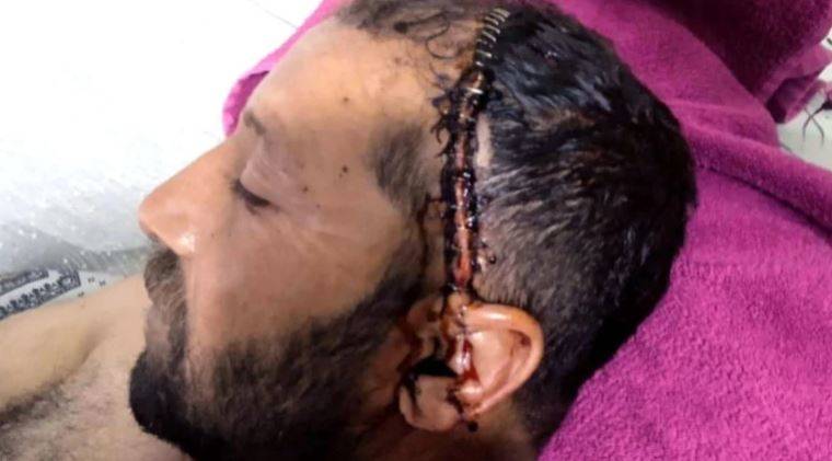 Kafasına 92 Dikiş Atıldı! Karara İtiraz Etti