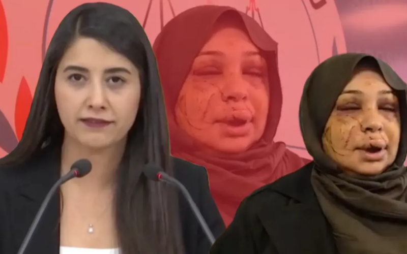 Dilan Kunt Ayan’dan Serbestlik Kararına Tepki