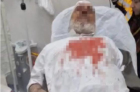 Şanlıurfa’da 72 Yaşındaki Adamı Darp Eden 4 Şüpheli Tutuklandı