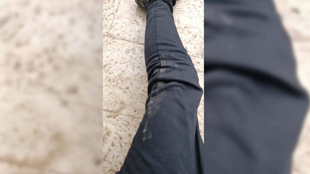 Suruç'ta düzenlenen yürüyüşü takip eden İHA muhabiri yaralandı