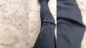 Suruç'ta düzenlenen yürüyüşü takip eden İHA muhabiri yaralandı