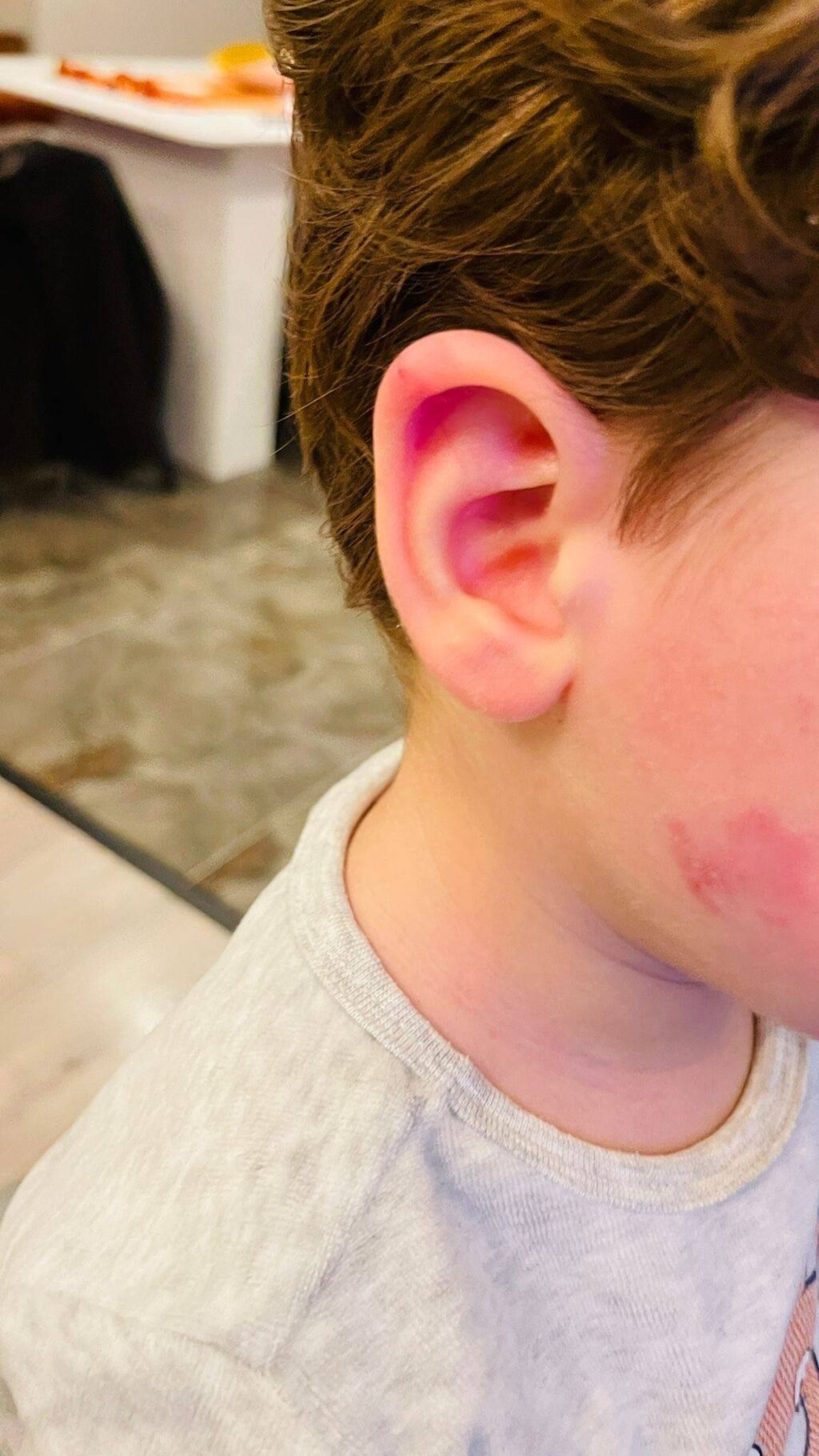 Kreşte skandal olay: Çocuğunu darp edilmiş halde buldu!